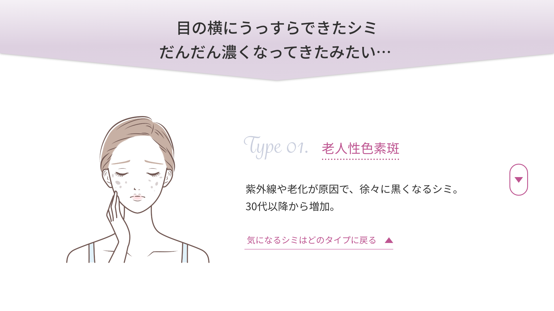 目の横にうっすらできたシミだんだん濃くなってきたみたい…「老人性色素斑」