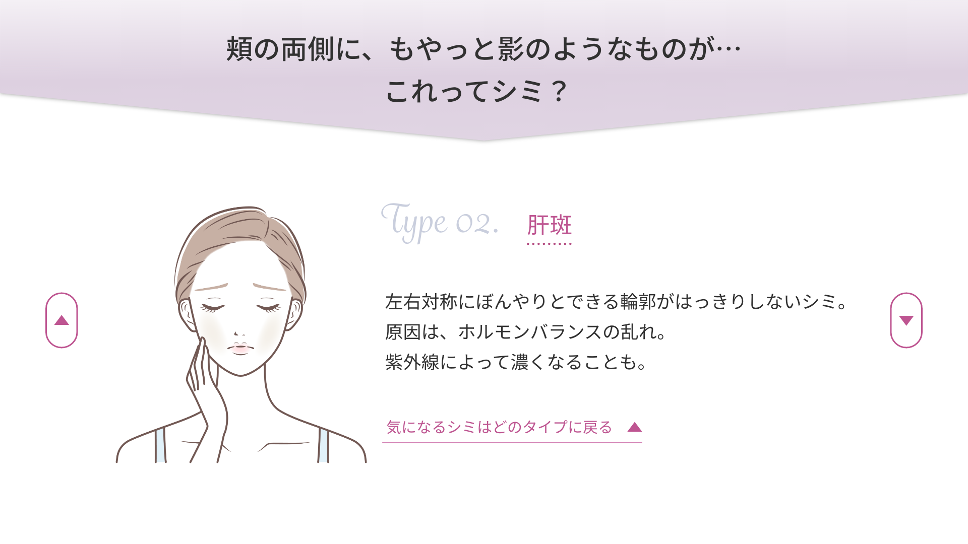 頬の両側に、もやっと影のようなものが…これってシミ？「肝斑」