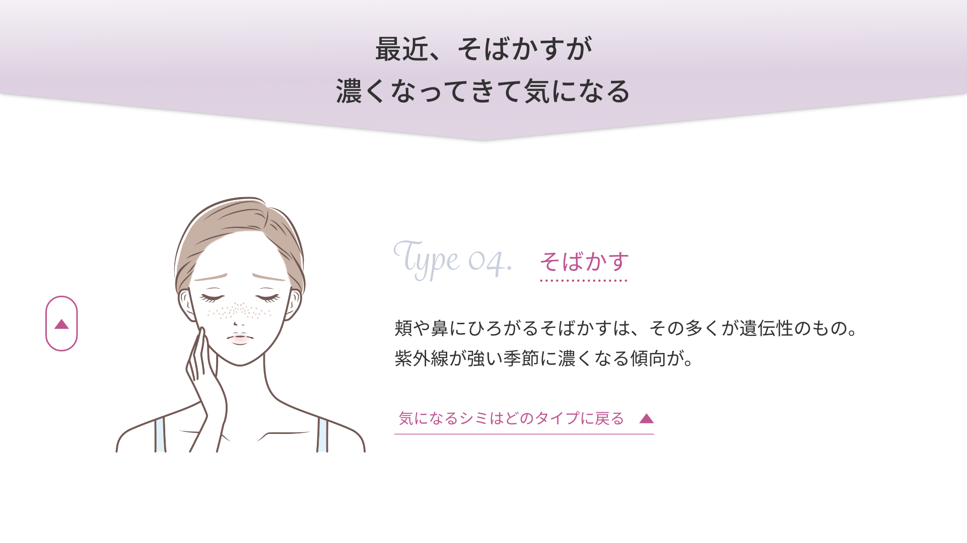 最近、そばかすが濃くなってきて気になる「そばかす」